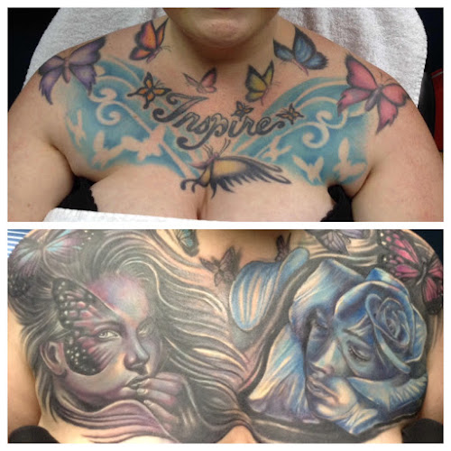 Work by Removery Tattoo Removal & Fading
