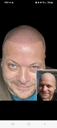 Work by Empowerment Ink Scalp Micropigmentation